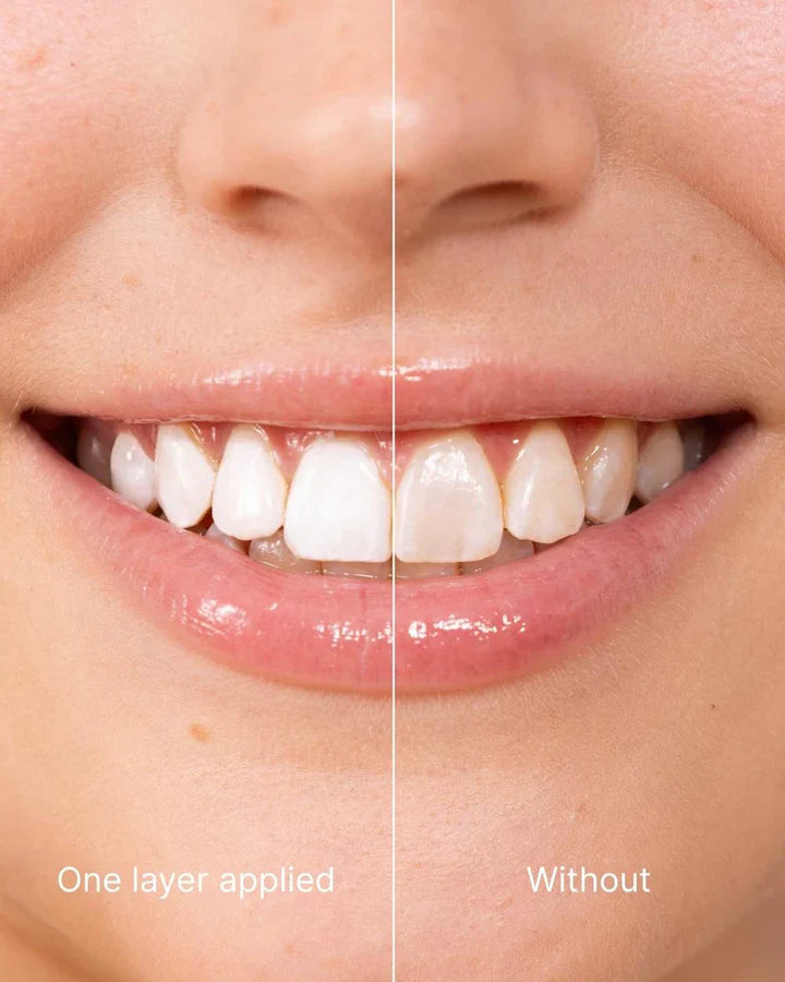 WOW Instant White Teeth Polish — Up to 7+ Shades Whiter, Vegan & Safe