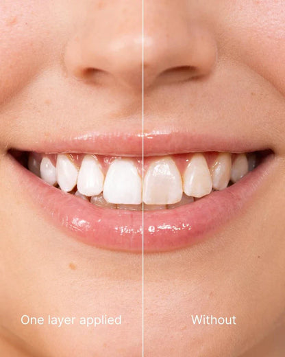 WOW Instant White Teeth Polish — Up to 7+ Shades Whiter, Vegan & Safe