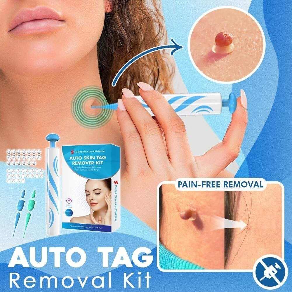 SMART Auto micro skin tag remover