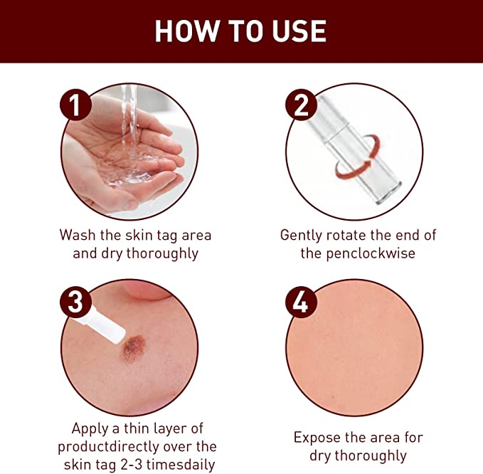 Tags & Moles Remover
